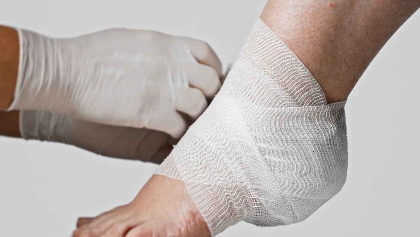 Fixierung des Biatain Superabsorber an der Ferse