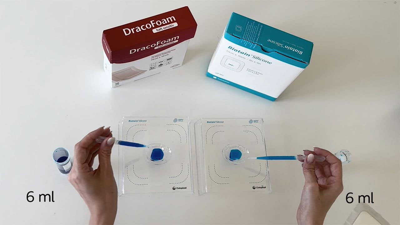 Wölbung des Biatain® Silicone Schaumverbandes