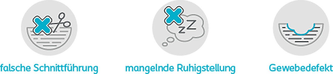 Ursachen einer Wunddehiszenz: falsche Schnittführung, fehlende Ruhigstellung und bestehender Gewebedefekt.