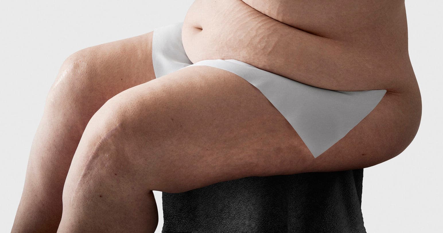 Hautfalten gezielt und effektiv versorgen