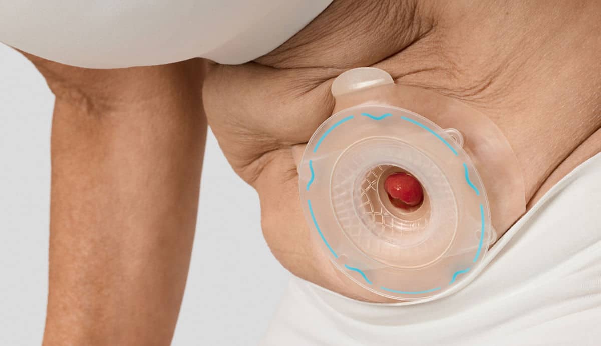 Flexibilität und Kompressibilität in der Praxis