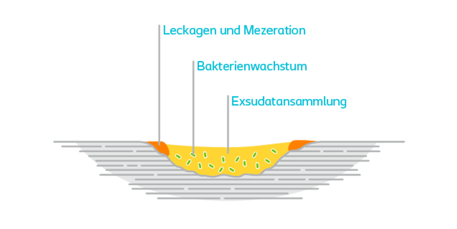 Exsudatansammlung, Bakterienwachstum und Mazeration als Folgen unzureichenden Wundexsudat-Managements.