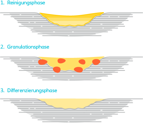 Grafik der drei Wundheilungsphasen: Reinigungsphase, Granulationsphase und Differenzierungs- bzw. Epithelisierungsphase.