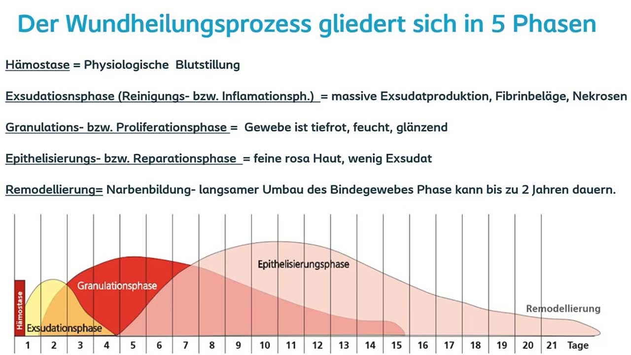 Chronische Wunden im Praxisalltag