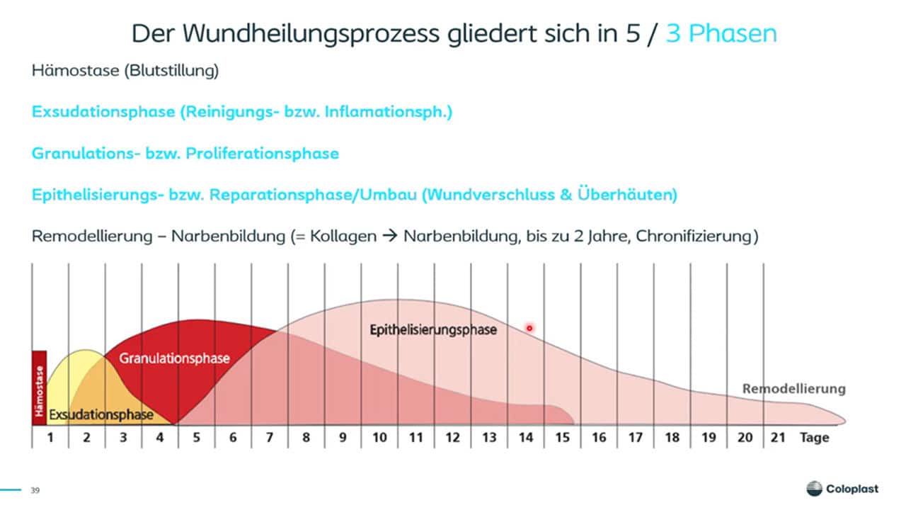 Teaser: Wundphasen und Wundreinigung