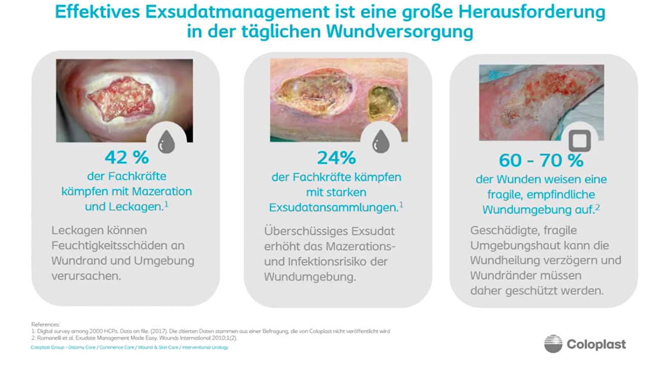 Exsudatansammlungen vermeiden – Die Wölbung bringt den Unterschied​